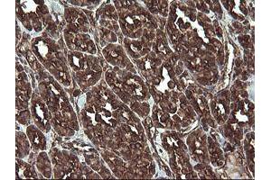 Image no. 2 for anti-Receptor Accessory Protein 5 (REEP5) antibody (ABIN1500659)