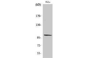 Western Blotting (WB) image for anti-PMS2 Postmeiotic Segregation Increased 2 (S. Cerevisiae) (PMS2) (Internal Region) antibody (ABIN3180270) (PMS2 anticorps  (Internal Region))