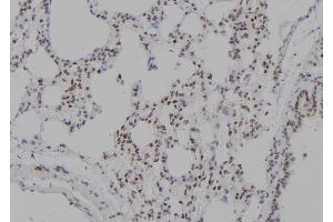 ABIN6277236 at 1/100 staining Rat lung tissue by IHC-P. (TCOF1 anticorps  (N-Term))