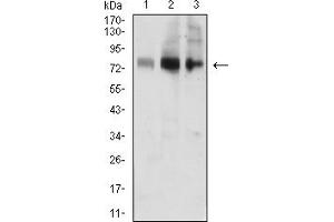 Western blot analysis using ACSS1 mouse mAb against MOLT4 (1), Jurkat (2), and HL-60 (3) cell lysate. (ACSS1 anticorps  (AA 548-689))