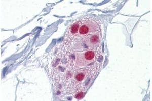 Anti-NR3C1 / Glucocorticoid Receptor antibody IHC staining of human colon, submucosal plexus.