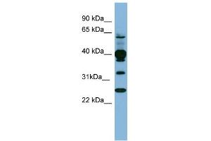 WB Suggested Anti-PLEK Antibody Titration: 0. (Pleckstrin anticorps  (N-Term))