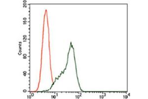 Immunohistochemical analysis of paraffin-embedded rectum cancer tissues using STAT5A antibody with DAB staining. (STAT5A anticorps  (AA 583-794))