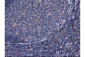 anti-Catalase (CAT) antibody