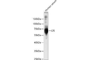 Western blot analysis of extracts of Human serum, using CFI antibody (ABIN6127713, ABIN6138461, ABIN6138462 and ABIN6221257) at 1:500 dilution. (Complement Factor I anticorps  (AA 19-300))