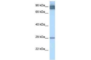 Western Blot showing LRAT antibody used at a concentration of 1. (LRAT anticorps  (N-Term))