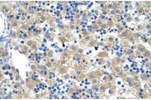 Immunohistochemical staining (Formalin-fixed paraffin-embedded sections) of human liver with FERD3L polyclonal antibody  at 4-8 ug/mL working concentration. (FERD3L anticorps  (N-Term))