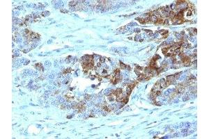 anti-Blood Group H antibody