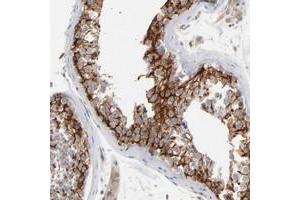 Immunohistochemical staining of human testis with ITPR3 polyclonal antibody  shows cytoplasmic positivity in cells in seminiferus ducts at 1:200-1:500 dilution. (ITPR3 anticorps)