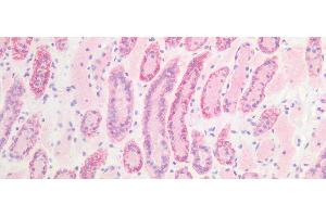 Detection of 0 in Human Kidney Tissue using Monoclonal Antibody to E-cadherin