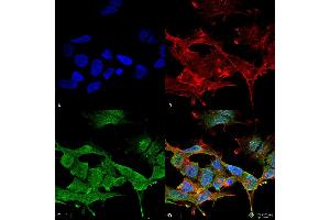 Immunocytochemistry/Immunofluorescence analysis using Mouse Anti-Clcn3 Monoclonal Antibody, Clone S258-5 . (CLCN3 anticorps  (AA 98-115))