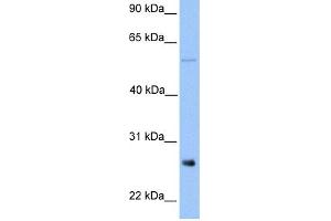 WB Suggested Anti-METTL7B Antibody Titration:  0. (METTL7B anticorps  (Middle Region))