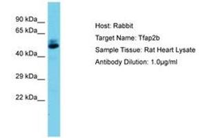 Image no. 1 for anti-Transcription Factor AP-2 beta (Activating Enhancer Binding Protein 2 Beta) (TFAP2B) (AA 104-153) antibody (ABIN6750458) (TFAP2B anticorps  (AA 104-153))