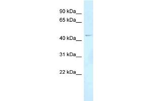 WB Suggested Anti-FOXN2 Antibody Titration: 1.