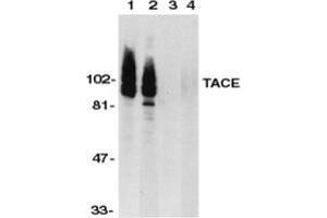 Western blot analysis of TACE in HeLa (1,3) and Jurkat (2,4) whole cell lysate in the absence (1,2) or presence (3,4) of blocking peptide with TACE Antibody  at 1 μg/ml.
