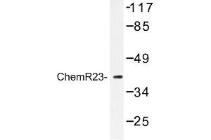 Image no. 1 for anti-Chemokine-Like Receptor 1 (CMKLR1) antibody (ABIN272278) (CMKLR1 anticorps)