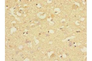 Immunohistochemistry of paraffin-embedded human brain tissue using ABIN7148481 at dilution of 1:100 (CNTNAP1 anticorps  (AA 20-300))