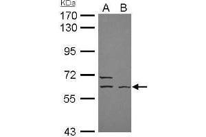 WB Image ELP3 antibody [N3C3] detects ELP3 protein by Western blot analysis. (ELP3/KAT9 anticorps  (Center))