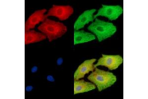 ABIN7096262 and ABIN7100324 staining  cells by IF/ICC.