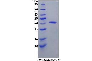 SDS-PAGE (SDS) image for Matrix Metallopeptidase 1 (Interstitial Collagenase) (MMP1) (AA 98-275) protein (His tag) (ABIN1525518) (MMP1 Protein (AA 98-275) (His tag))