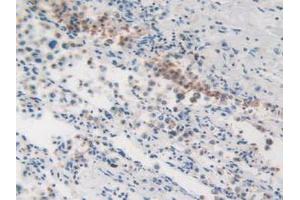 IHC-P analysis of Human Lung Tissue, with DAB staining. (MVP anticorps  (AA 2-272))