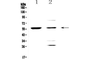 Western blot analysis of PDK1 using anti-PDK1 antibody .