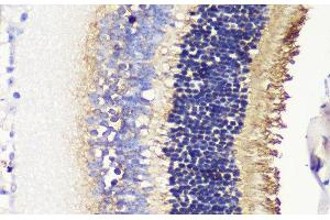 Immunohistochemistry of paraffin-embedded Mouse retina using PDC Polyclonal Antibody at dilution of 1:200 (40x lens). (Phosducin anticorps)
