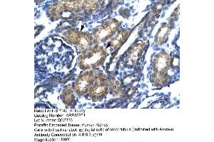 Immunohistochemistry (IHC) image for anti-SP140 Nuclear Body Protein (SP140) (N-Term) antibody (ABIN2777631) (SP140 anticorps  (N-Term))