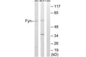 Western blot analysis of extracts from HUVEC cells, MCF-7 cells and 293 cells, using Fyn (Ab-530) antibody.