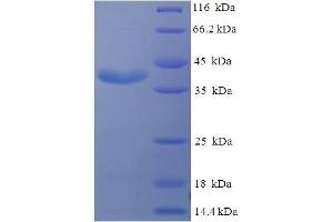 SDS-PAGE (SDS) image for Prolactin (PRL) (AA 31-229) protein (His-SUMO Tag) (ABIN5710149)