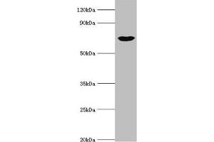 Western blot All lanes: cGMP-dependent protein kinase 1 antibody at 3 μg/mL + Mouse lung tissue Secondary Goat polyclonal to rabbit IgG at 1/10000 dilution Predicted band size: 77, 78, 45 kDa Observed band size: 77 kDa (PRKG1 anticorps  (AA 1-300))