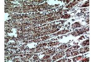 Immunohistochemistry (IHC) analysis of paraffin-embedded Human Stomach, antibody was diluted at 1:100. (PPP1R15B anticorps  (Internal Region))