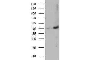 HEK293T cells were transfected with the pCMV6-ENTRY control (Left lane) or pCMV6-ENTRY MAGEB18 (Right lane) cDNA for 48 hrs and lysed. (MAGEB18 anticorps)