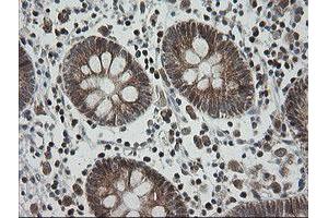 Image no. 6 for anti-Mitochondrial Ribosomal Protein S34 (MRPS34) antibody (ABIN1499564)