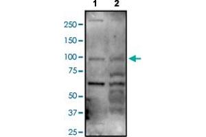 Western blot analysis of Lane 1: A549 and Lane 2: MCF-7 cell lysates with ARHGAP12 polyclonal antibody . (ARHGAP12 anticorps)