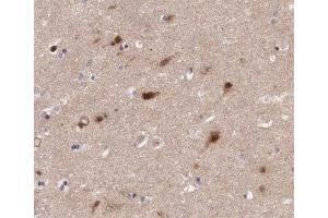 ABIN6266568 at 1/200 staining human brain tissue sections by IHC-P. (PRAF2 anticorps  (C-Term))