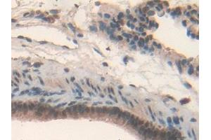 Detection of IL17RD in Rat Lung Tissue using Polyclonal Antibody to Interleukin 17 Receptor D (IL17RD) (IL17RD anticorps  (AA 356-605))