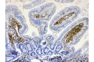IHC testing of FFPE mouse intestine tissue with LYN antibody at 1ug/ml.
