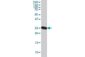 CLPP monoclonal antibody (M01), clone 3E2 Western Blot analysis of CLPP expression in A-431 .