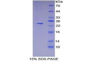 SDS-PAGE analysis of Pig MHCDRa Protein. (HLA-DRA Protéine)
