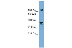 WB Suggested Anti-LAMP1 Antibody Titration: 0. (LAMP1 anticorps  (N-Term))