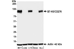 Western Blotting (WB) image for anti-CD276 (CD276) (C-Term) antibody (ABIN7455195)
