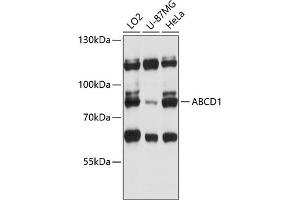 Western blot analysis of extracts of various cell lines, using  antibody (ABIN6129183, ABIN6136369, ABIN6136370 and ABIN6215725) at 1:3000 dilution. (ABCD1 anticorps  (AA 340-500))