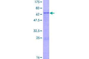 Growth Differentiation Factor 3 (GDF3) (AA 1-364) protein (GST tag)
