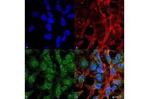 Immunocytochemistry/Immunofluorescence analysis using Rabbit Anti-UVRAG Polyclonal Antibody .