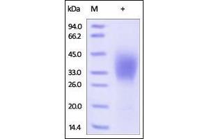 Human CD58, His Tag on SDS-PAGE under reducing (R) condition.