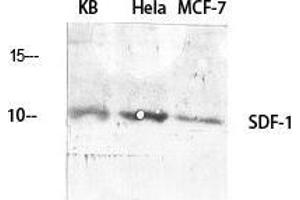 Western Blot (WB) analysis of specific cells using SDF-1 Polyclonal Antibody. (CXCL12 anticorps  (C-Term))