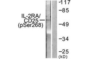 Western blot analysis of extracts from LOVO cells, using IL-2R alpha/CD25 (Phospho-Ser268) Antibody. (CD25 anticorps  (pSer268))