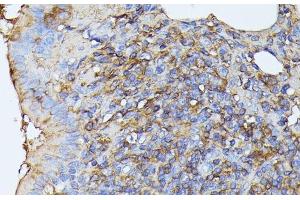 Immunohistochemistry of paraffin-embedded Rat lung using STK24 Polyclonal Antibody at dilution of 1:100 (40x lens). (STK24 anticorps)