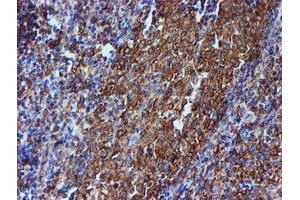 Image no. 3 for anti-Tubulin beta 4a (TUBB4A) antibody (ABIN1501579)